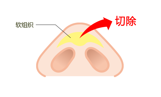 アプローチ法2