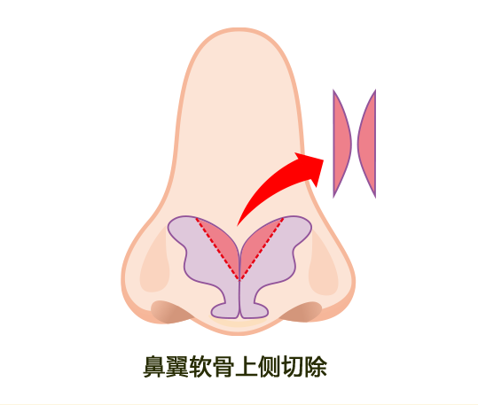 アプローチ法3