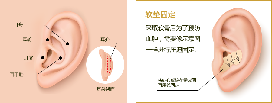 耳介軟骨