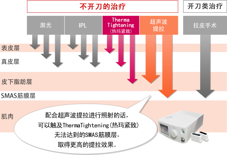 より効果的なリフトアップ