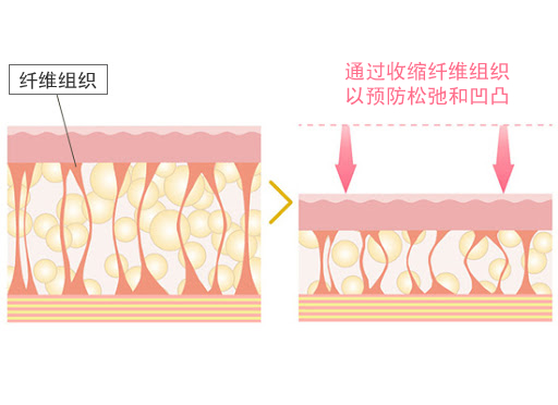 皮膚のタイトニング（引き締め）効果がある 画像03